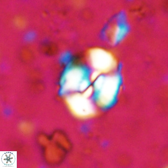 Watznaueria paenepelagicus VR 20748