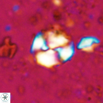 Watznaueria paenepelagicus VR 20750