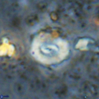 Watznaueria paenepelagicus VR 20751