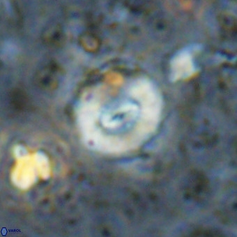 Watznaueria paenepelagicus VR 20753