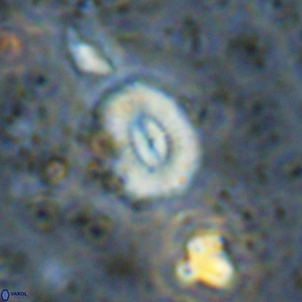 Watznaueria paenepelagicus VR 20755