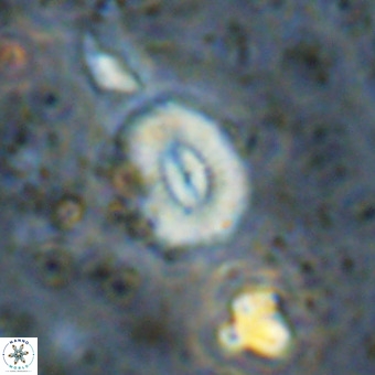 Watznaueria paenepelagicus VR 20755