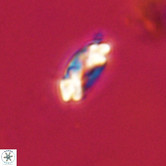 Watznaueria paenepelagicus VR 23251