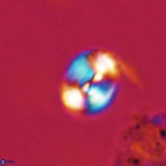 Watznaueria paenepelagicus VR 23265