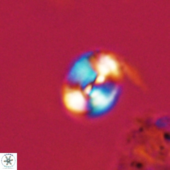 Watznaueria paenepelagicus VR 23265