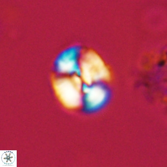 Watznaueria paenepelagicus VR 23271