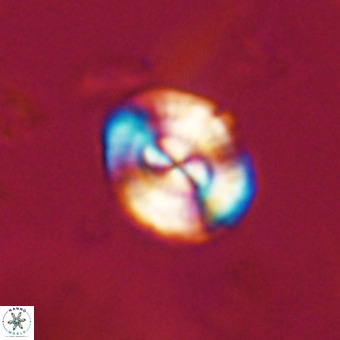 Watznaueria paenepelagicus VR 23489