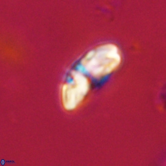 Watznaueria paenepelagicus VR 23505