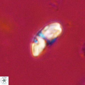 Watznaueria paenepelagicus VR 23505