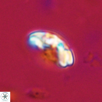 Watznaueria paenepelagicus VR 23509