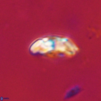 Watznaueria paenepelagicus VR 23512