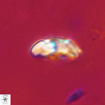 Watznaueria paenepelagicus VR 23512
