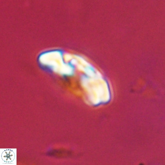 Watznaueria paenepelagicus VR 23518
