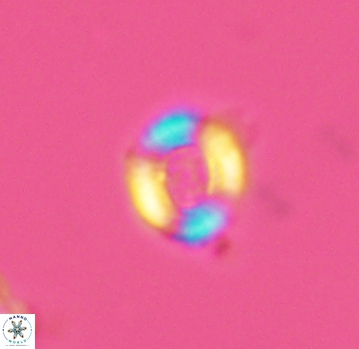 Watznaueria rawsonii 2791