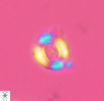 Watznaueria rawsonii 2792