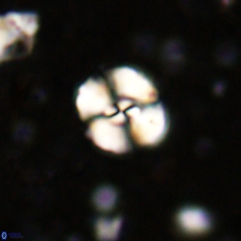 Watznaueria sp 3 VR 20399