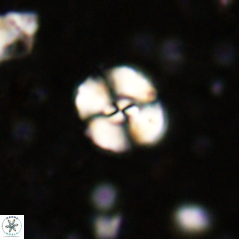 Watznaueria sp 3 VR 20399