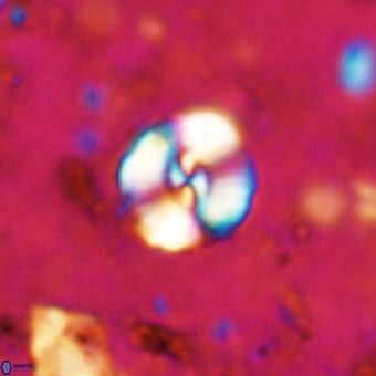 Watznaueria sp 3 VR 20404