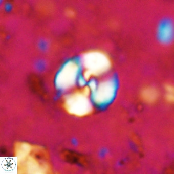 Watznaueria sp 3 VR 20404