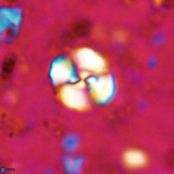 Watznaueria sp 3 VR 20400