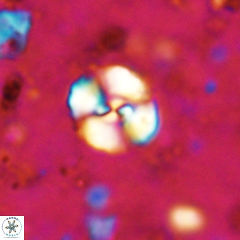 Watznaueria sp 3 VR 20400