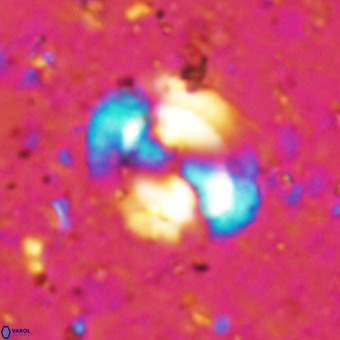 Watznaueria sp VR 21375