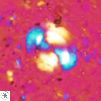 Watznaueria sp VR 21375