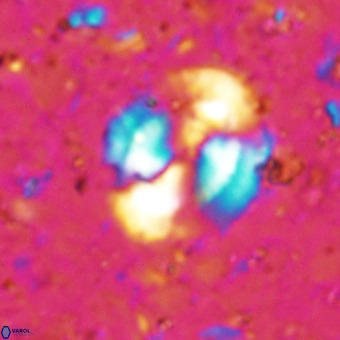 Watznaueria sp VR 21376