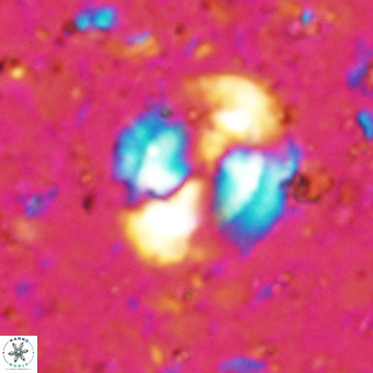 Watznaueria sp VR 21376