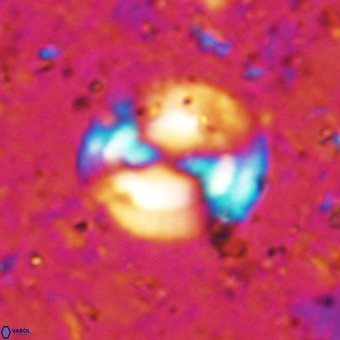 Watznaueria sp VR 21379