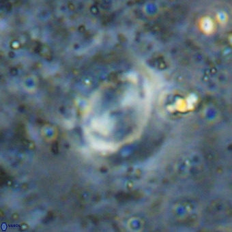 Watznaueria sp VR 21381