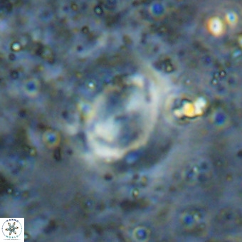 Watznaueria sp VR 21381