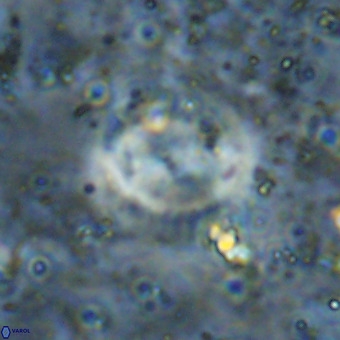 Watznaueria sp VR 21382