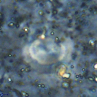 Watznaueria sp VR 21384