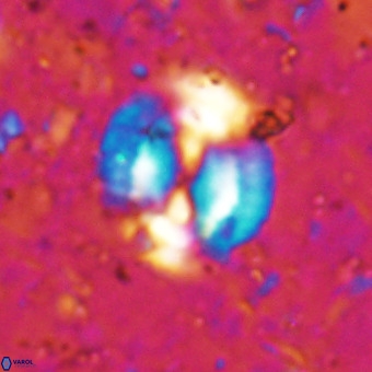 Watznaueria sp VR 21387