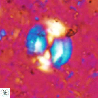 Watznaueria sp VR 21387