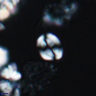 Watznaueria stenaspis 8861