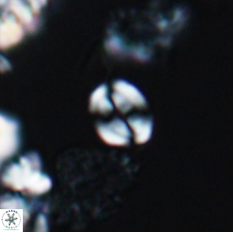 Watznaueria stenaspis 8861