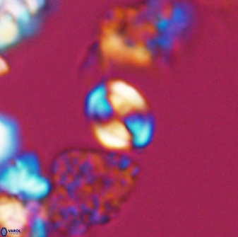 Watznaueria stenaspis 8862