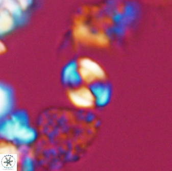 Watznaueria stenaspis 8862