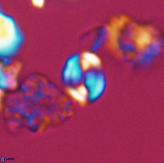 Watznaueria stenaspis 8863