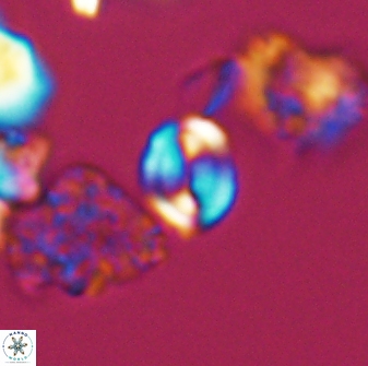 Watznaueria stenaspis 8863