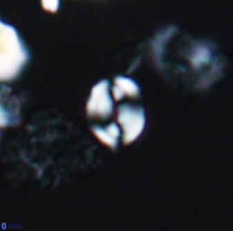 Watznaueria stenaspis 8864