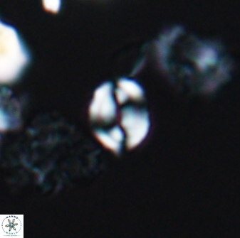 Watznaueria stenaspis 8864
