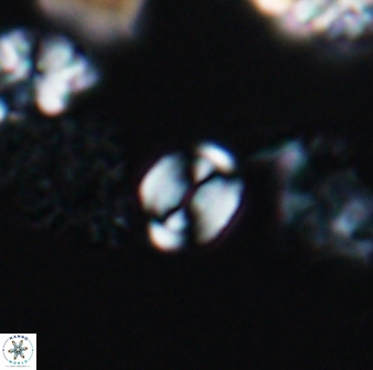 Watznaueria stenaspis 8865