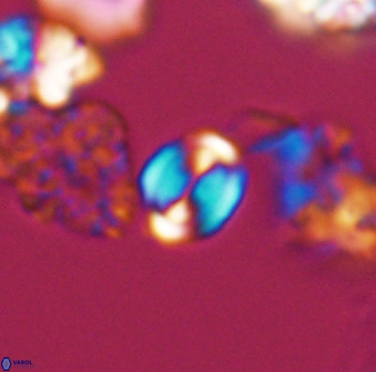 Watznaueria stenaspis 8866
