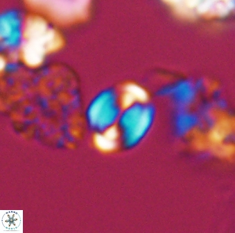 Watznaueria stenaspis 8866
