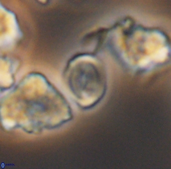 Watznaueria stenaspis 8867