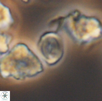 Watznaueria stenaspis 8867