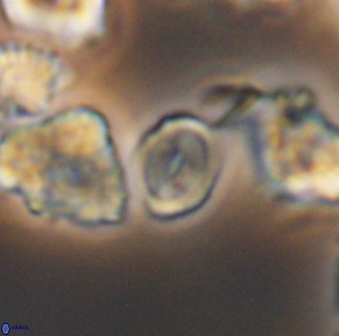 Watznaueria stenaspis 8868